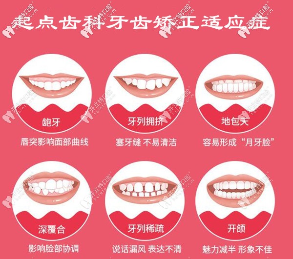 深圳起點(diǎn)口腔牙齒矯正多少錢