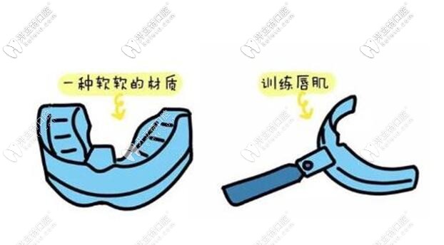 牙齒矯正器