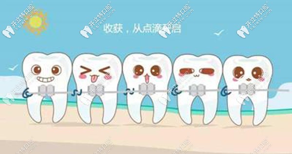 在綿陽做牙齒正畸的費用價格如下