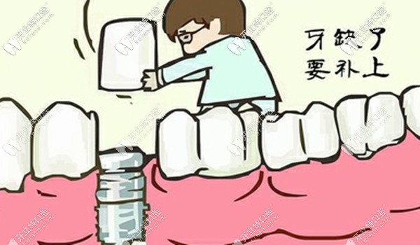 秦浩院長做滿口種植牙的技術(shù)如何