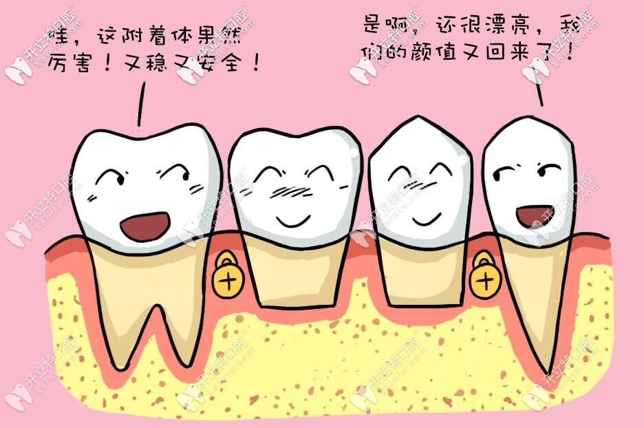 無掛鉤假牙 
