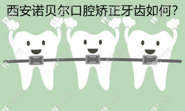 西安諾貝爾口腔矯正牙齒好不好，用正畸病例來評價下