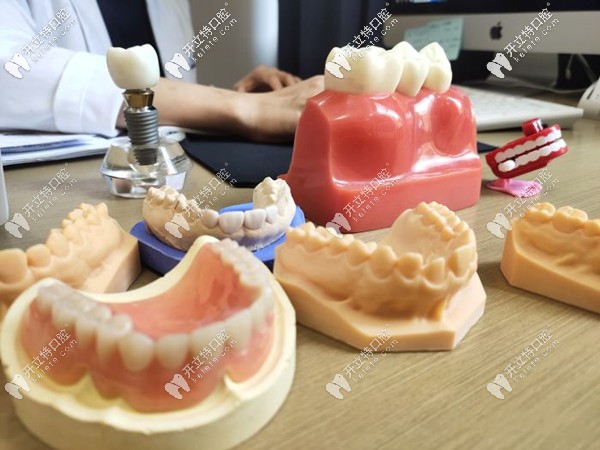 昆明美奧牙齒矯正模型