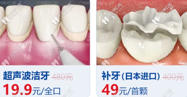 曙光口腔洗牙、補(bǔ)牙優(yōu)惠看這
