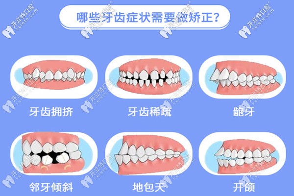 門牙不齊建議選擇正畸