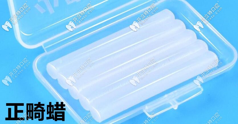 正畸過程中：容易嘴破，就用正畸蠟