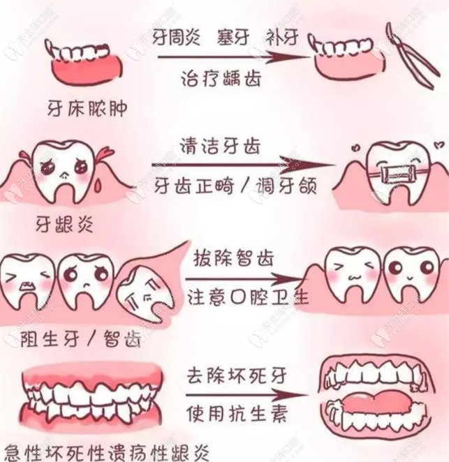 病理性口臭