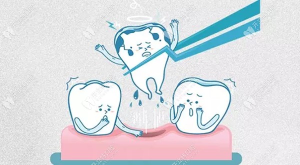 拔牙后留下的牙洞多久可以愈合,吃啥食物有利于盡快恢復(fù)