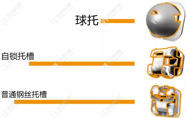 歐歐球型托槽和方型托槽的對(duì)比圖