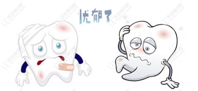 蛀洞太大補牙材料總掉該怎么辦？是時候了解長效補牙了