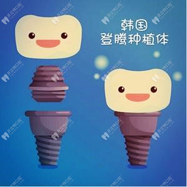 昆明做韓國(guó)純鈦登騰種植牙補(bǔ)貼價(jià)2399元一顆，也太便宜了吧