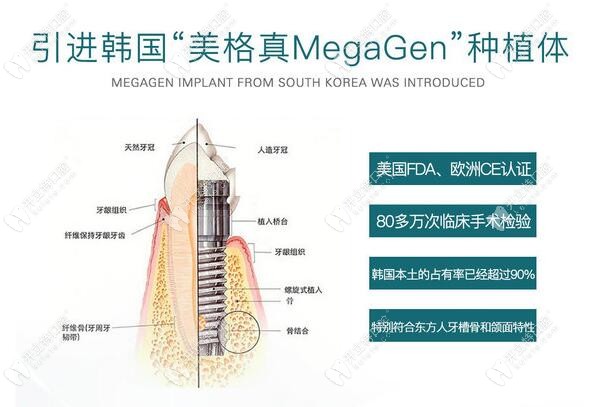 為啥都想看韓國美格真EZplus型號的介紹和種植流程圖呢
