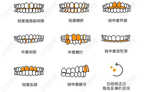 EASY SMILE牙套適應癥