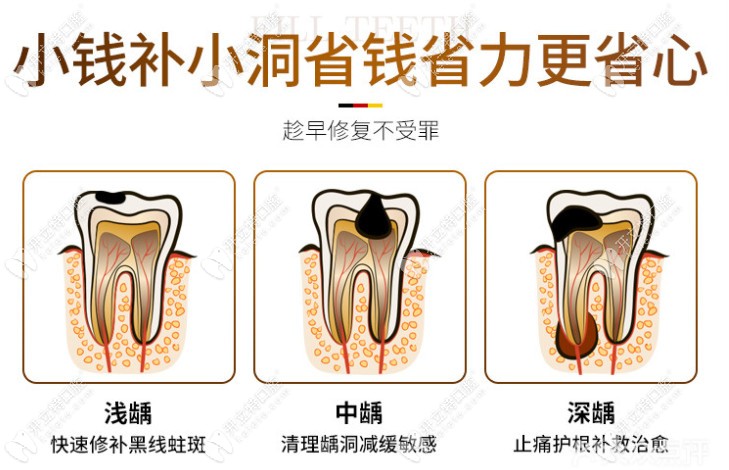廣州天河柏德口腔補(bǔ)牙優(yōu)惠