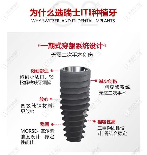 瑞士iti士卓曼種植體好嗎？