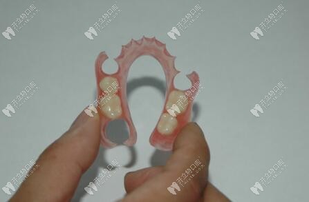 隱形義齒